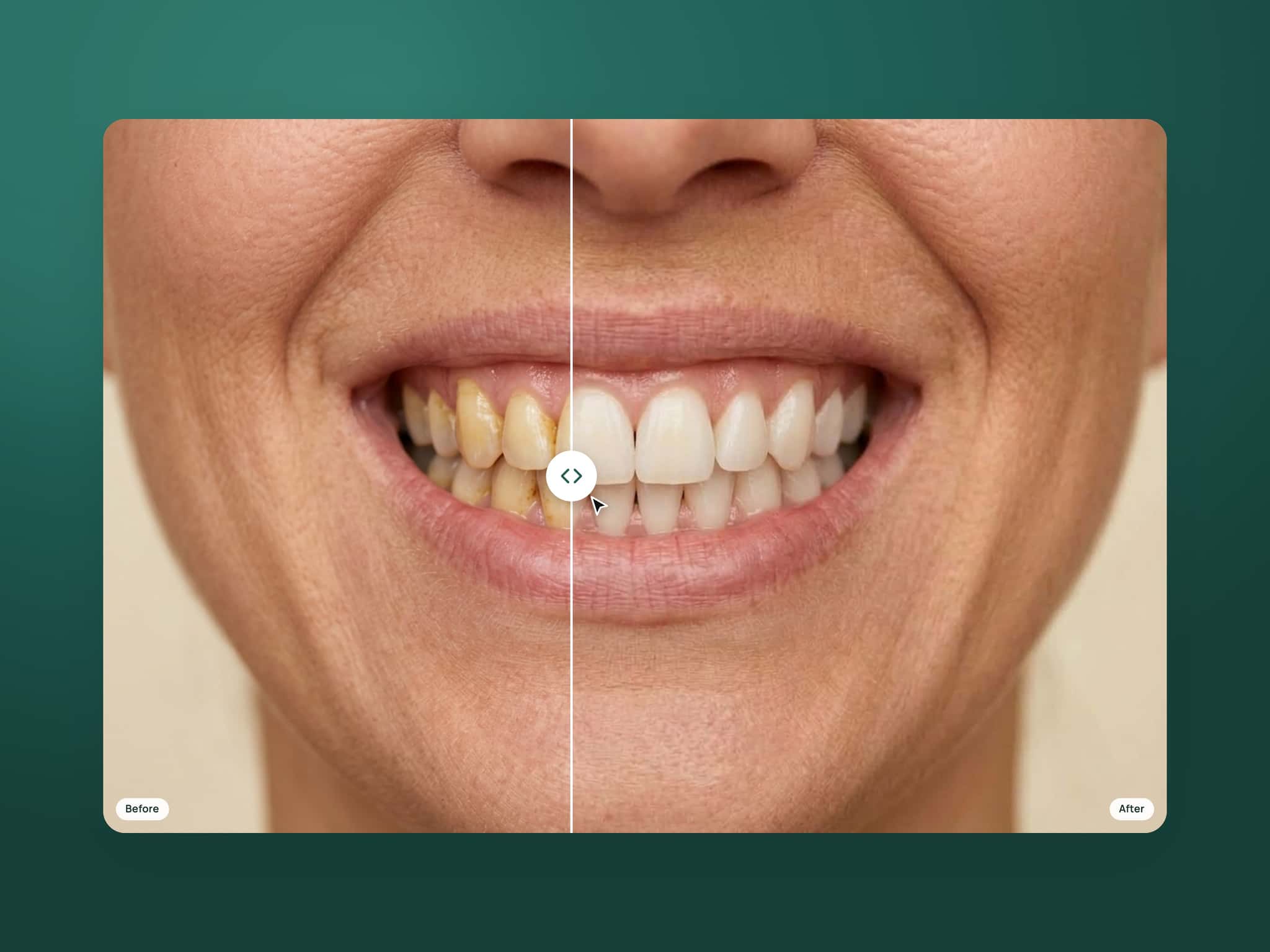 Verde Before After